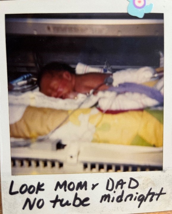 Doctors sent this photo to Fernandez so he knew Thomas no longer needed a feeding tube.