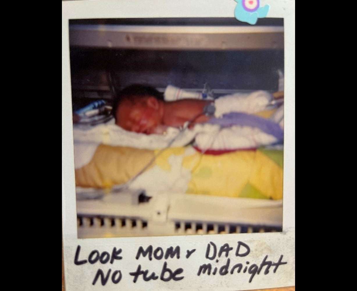 Doctors sent this photo to Fernandez so he knew Thomas no longer needed a feeding tube.