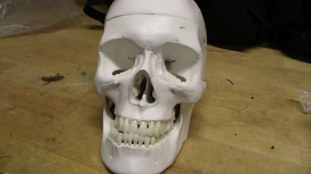 A medical training device shut down checked baggage screening operations at Salt Lake City International Airport for two hours on Sept. 18.