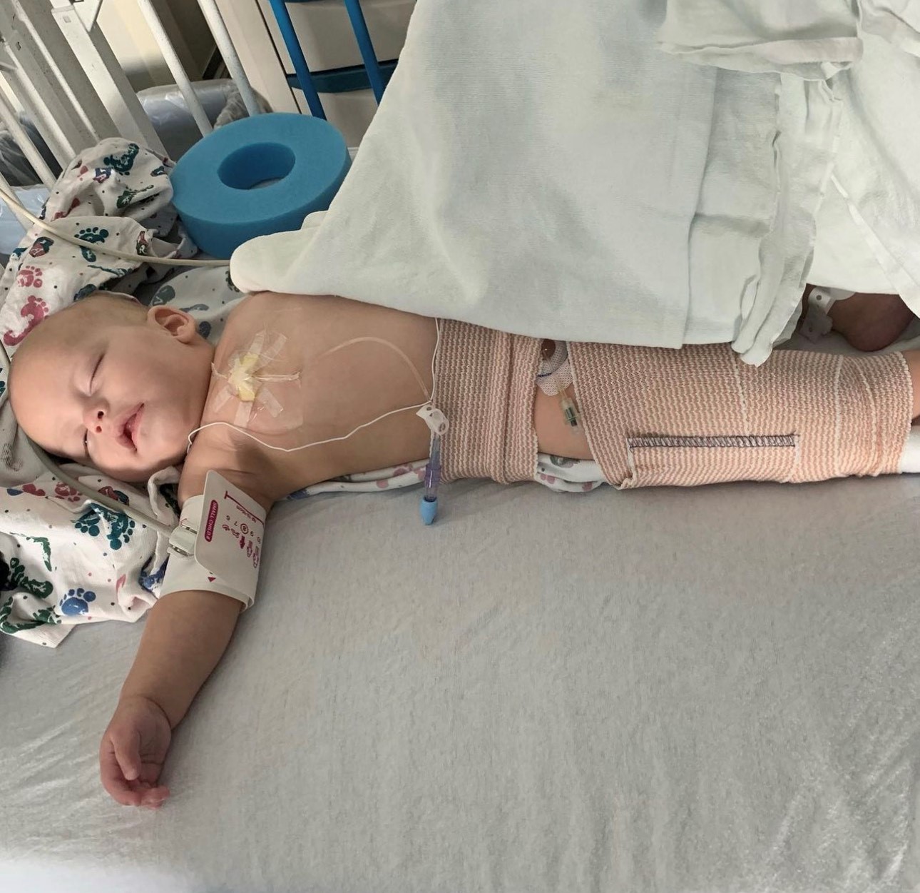 Benny is treated for retinoblastoma, a childhood eye cancer. He was about 6 months old when his mom noticed a discrepancy between his eyes on his baby monitor. He is now cancer free.