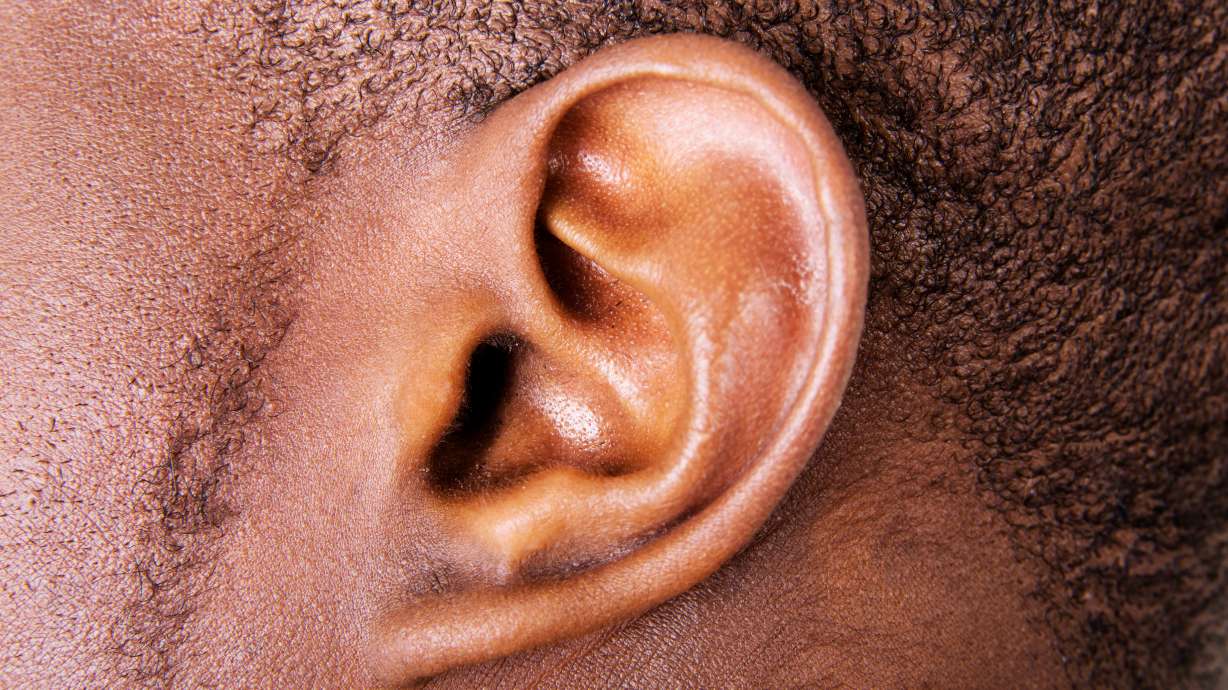 New research is among multiple efforts to create skin, tissue and cartilage to overcome congenital conditions like ear malformation.