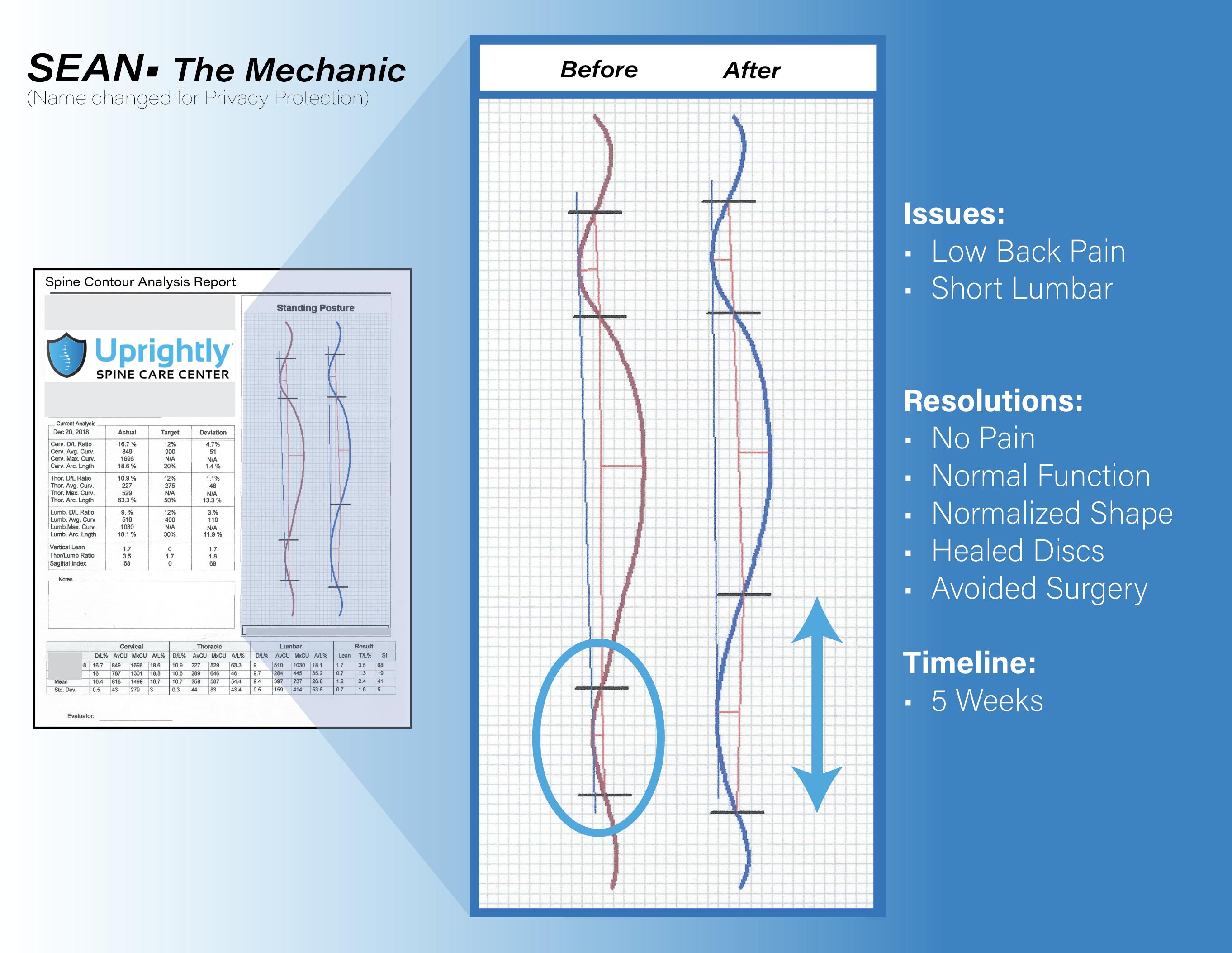 Innovative spine care program revolutionizes the way people deal with back and neck pain