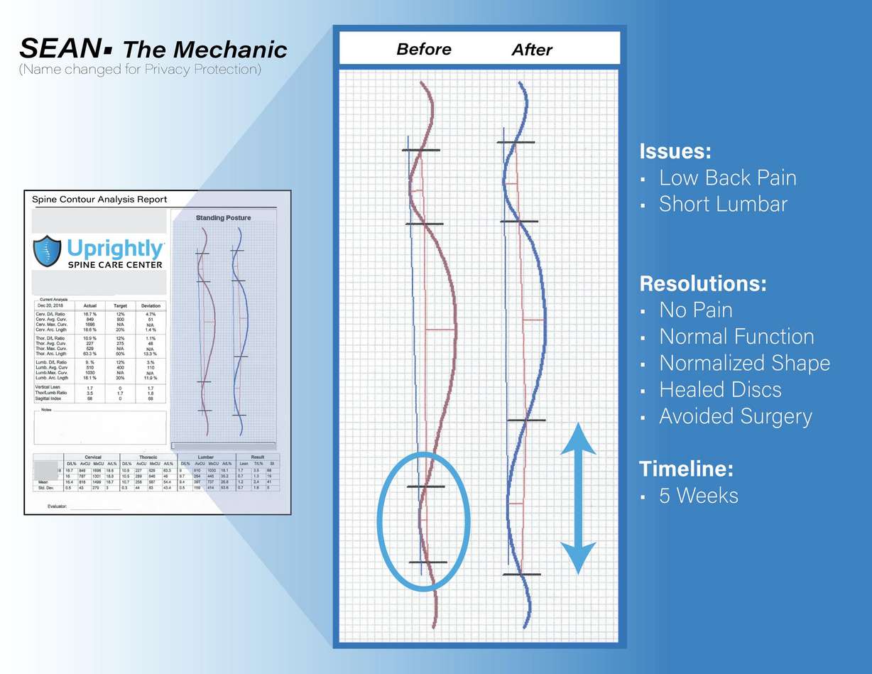 Innovative spine care program revolutionizes the way people deal with back and neck pain