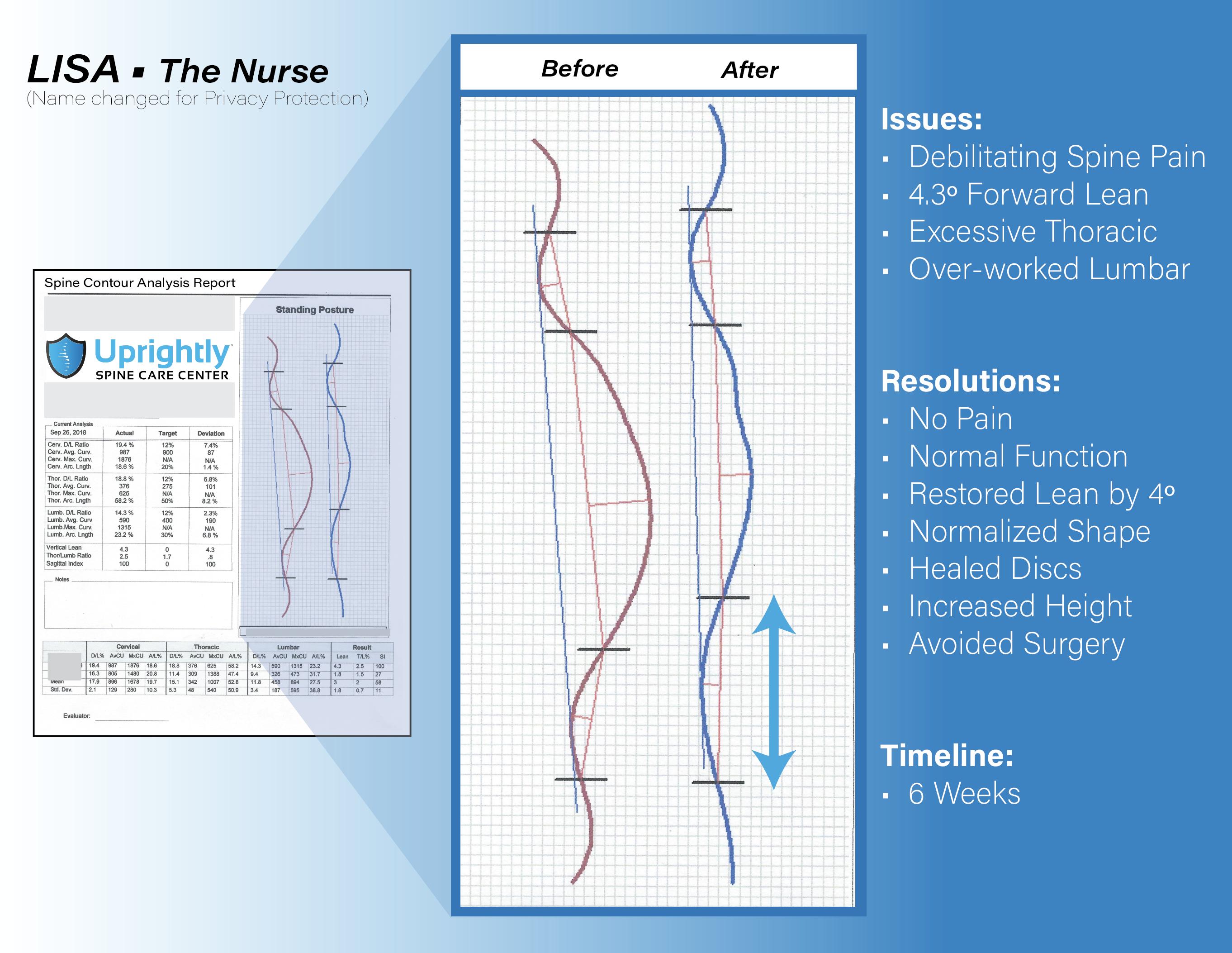 Innovative spine care program revolutionizes the way people deal with back and neck pain