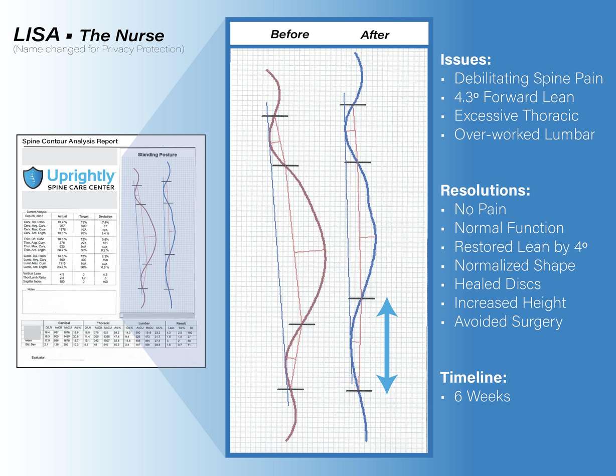 Innovative spine care program revolutionizes the way people deal with back and neck pain