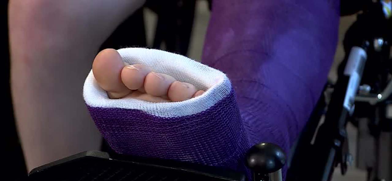 Max Winn suffered a broken leg when an SUV hit him and his mother in a crosswalk in Stansbury Park Oct. 30.