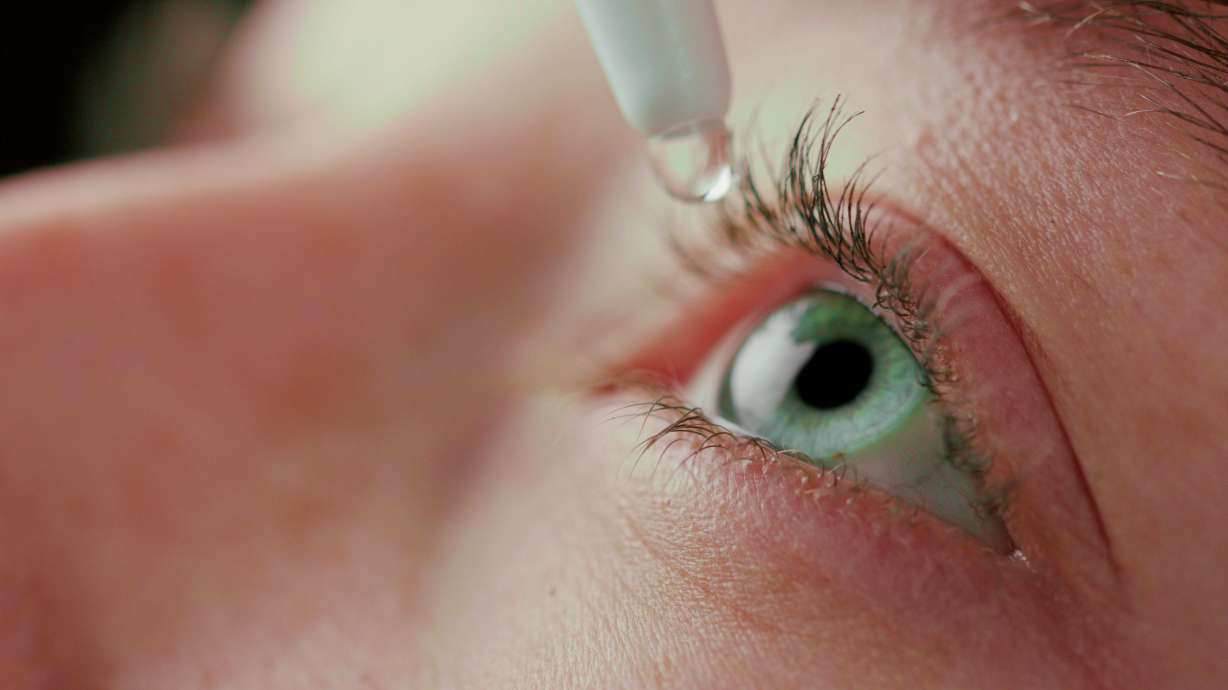 A manufacturer of 27 different eye drop products has issued a voluntary recall after the U.S. Food and Drug Administration said inspectors found unsanitary conditions at a manufacturing plant in India.