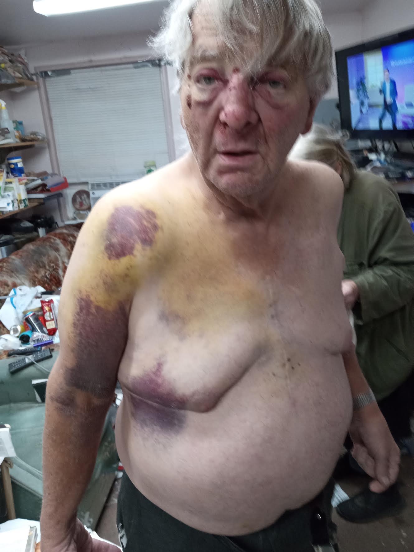 Rand Briem, 79, claims Ogden police officers used excessive force on him on Nov. 29, 2022, when they threw him to the ground for allegedly interfering with an arrest. Briem filed a lawsuit on Wednesday.
