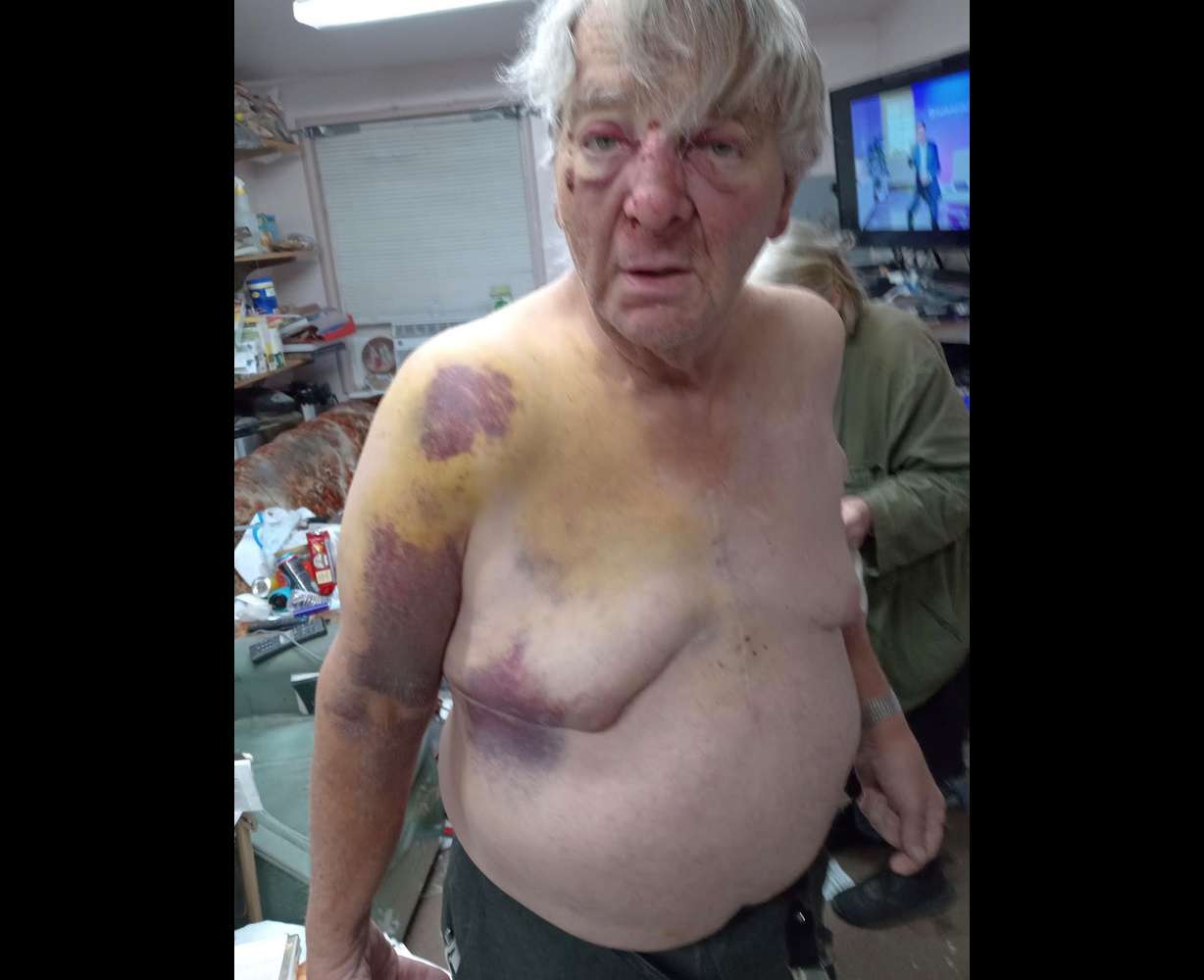 Rand Briem, 79, claims Ogden police officers used excessive force on him on Nov. 29, 2022, when they threw him to the ground for allegedly interfering with an arrest. Briem filed a lawsuit on Wednesday.