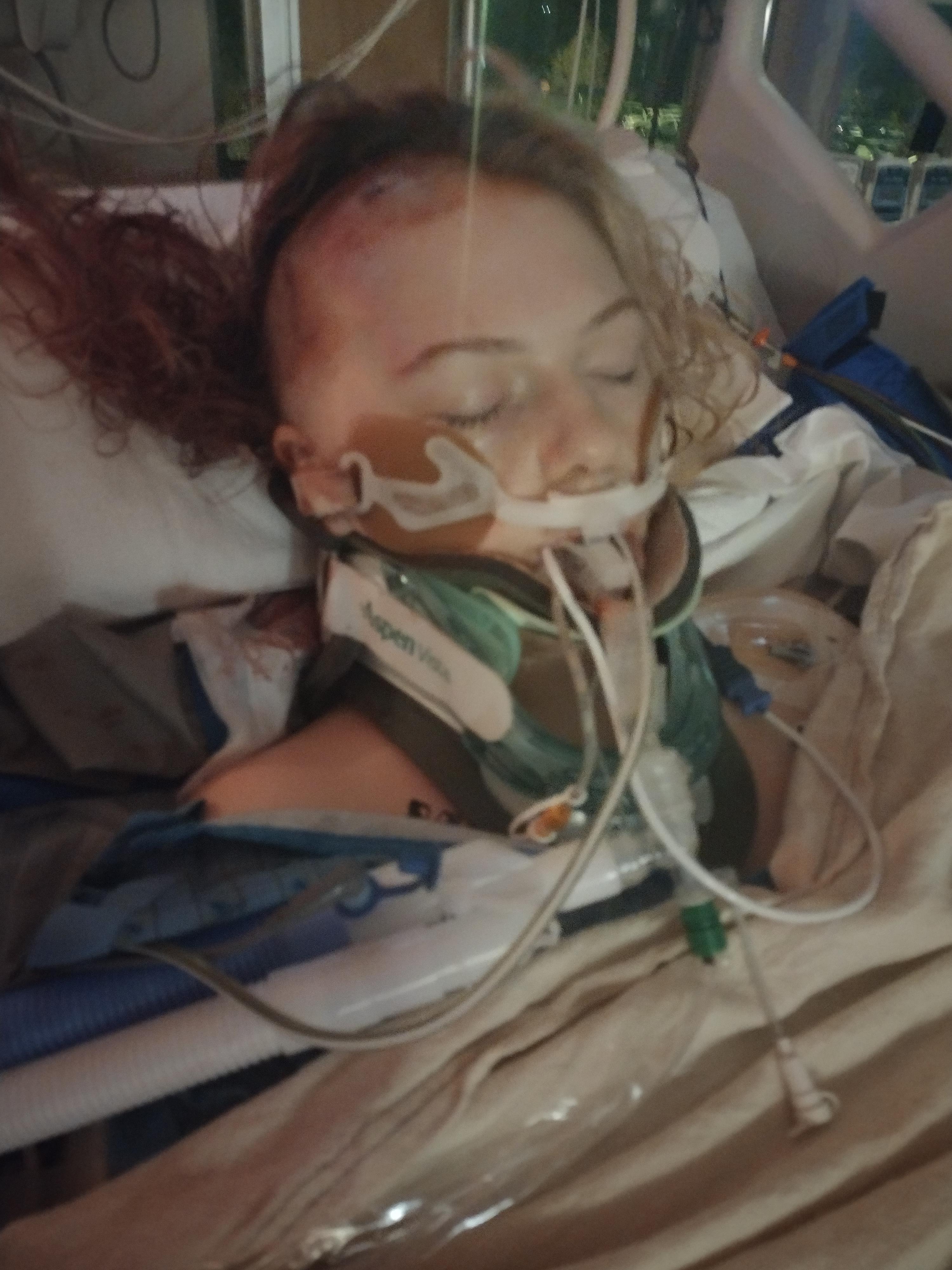 Tori Tibbitts suffered severe head trauma saving her brother from being hit by a pickup truck.The Denny's restaurant in Riverdale is organizing support for Tori, who works there.