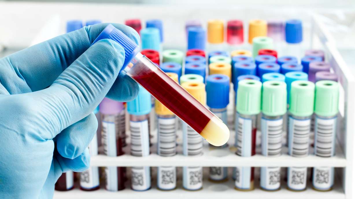 Researchers believe a simple blood test could identify the organs that are aging more quickly, leading to treatments and prevention measures even before any symptoms show up.