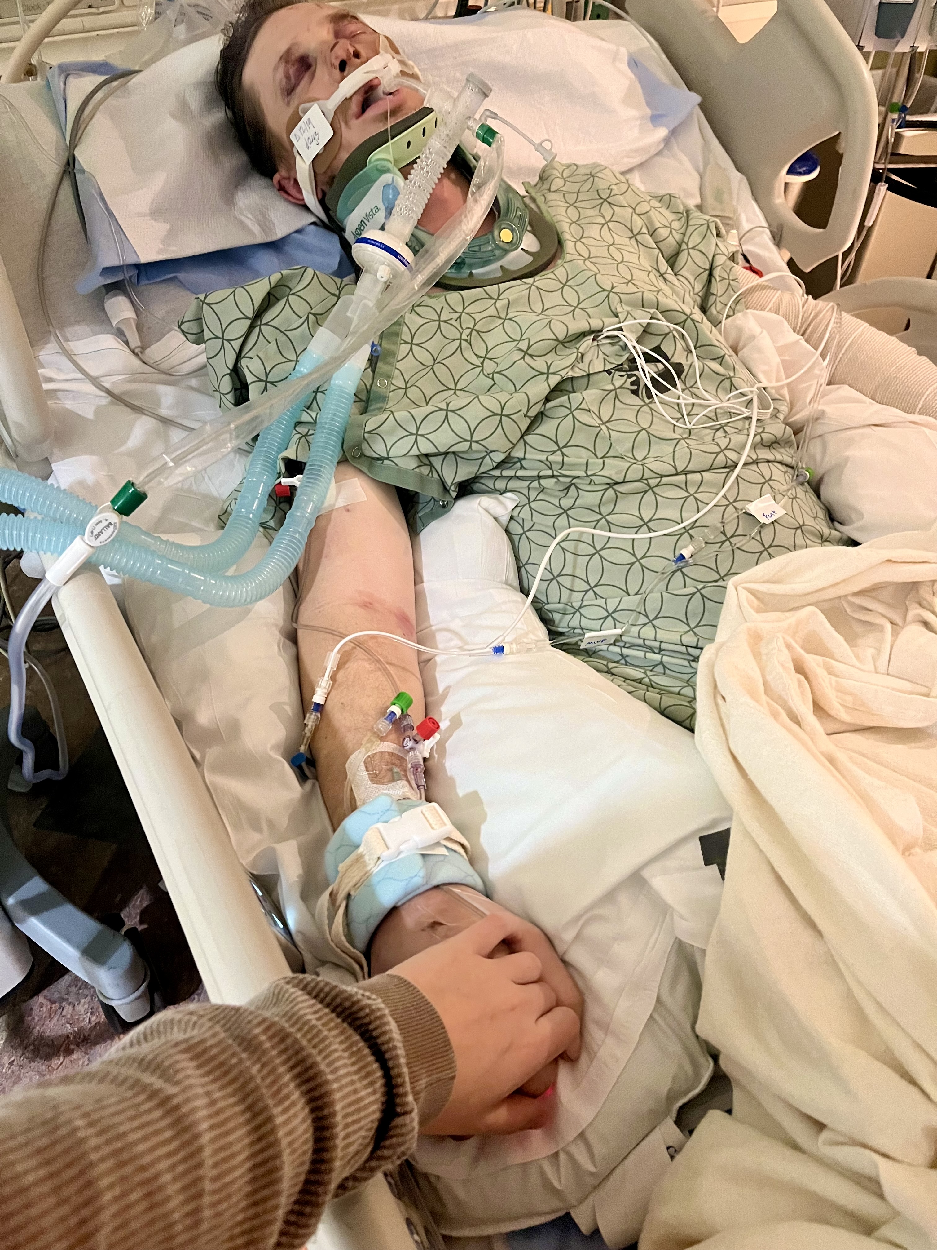 Family of man injured in wrong-way crash shares message of compassion