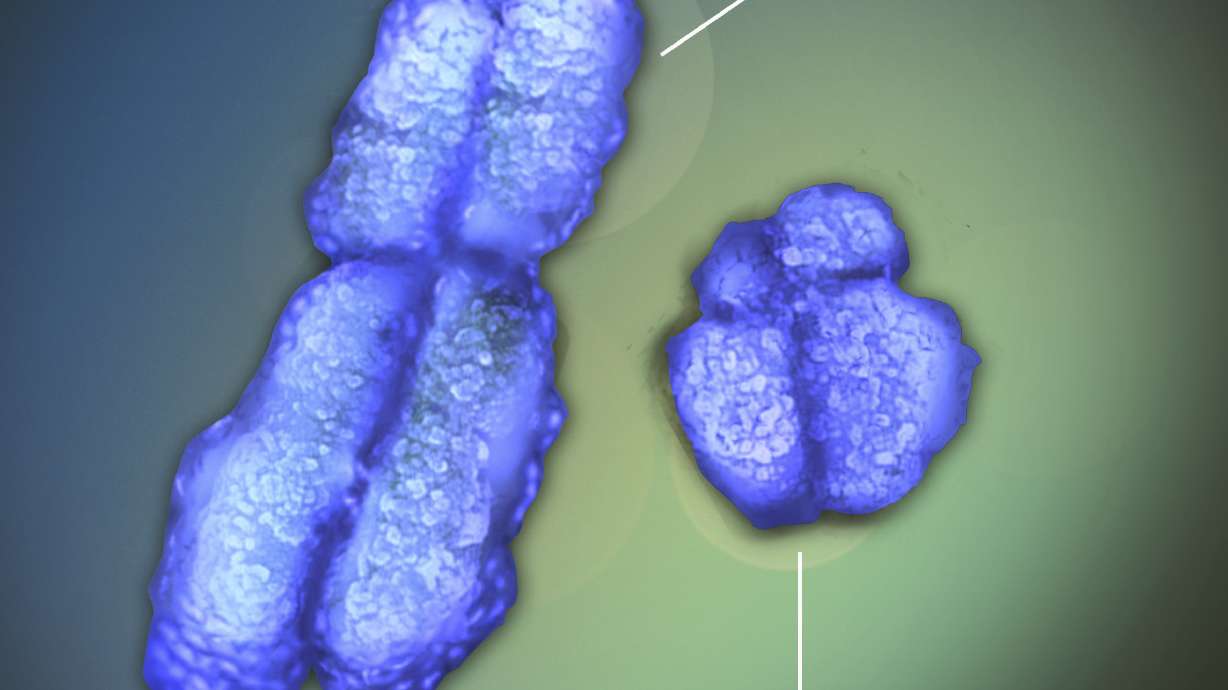 This image shows the X and Y chromosomes. Women are far more likely than men to get autoimmune diseases that occur when the immune system mistakenly attacks its own tissues. That gender disparity has baffled scientists for decades, but new research may finally explain why.