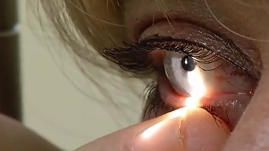A doctor looks at a patient's eye during an eye exam. A bill being considered by the Utah Legislature would lower the qualifications needed to perform some eye surgeries.