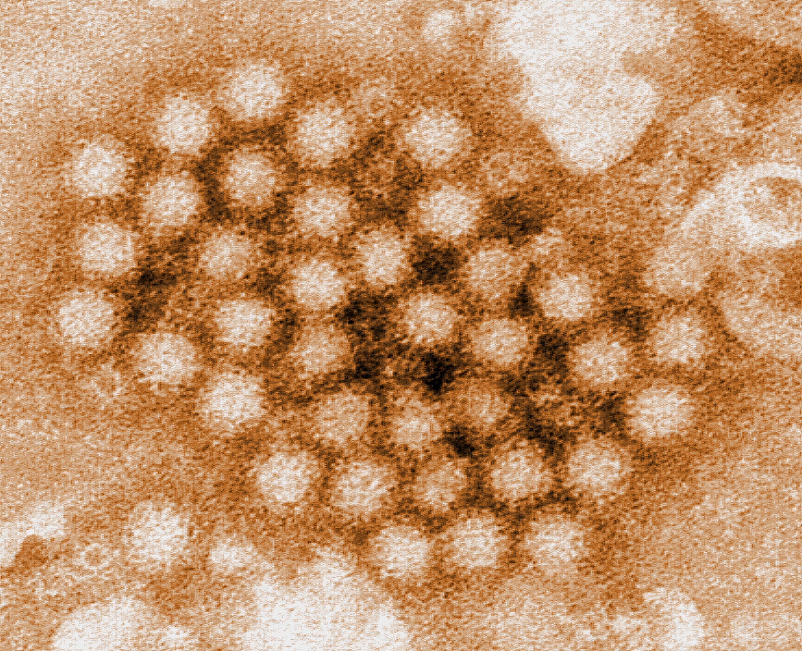 This digitally-colorized, transmission electron microscopic image revealed some of the ultrastructural morphology displayed by a cluster of norovirus virions, or virus particles.