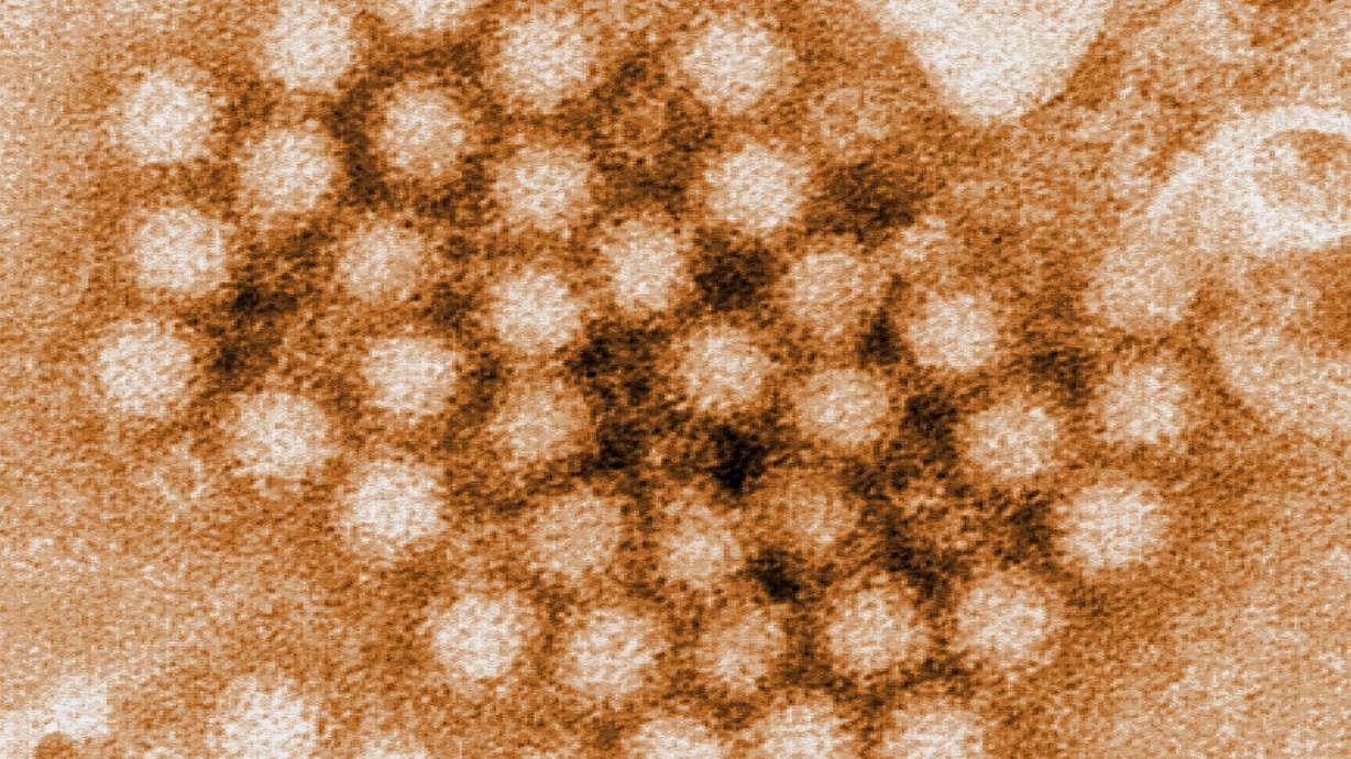 This digitally-colorized, transmission electron microscopic image revealed some of the ultrastructural morphology displayed by a cluster of norovirus virions, or virus particles.