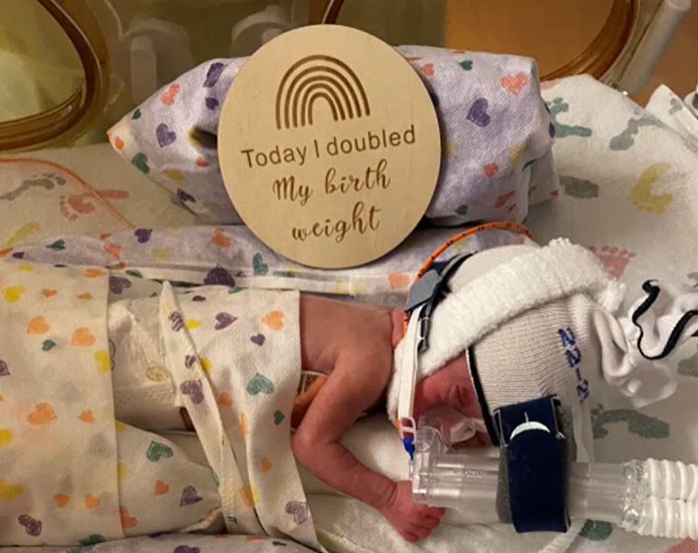 'Miracle baby’ Teddy Heredia, weighed only 14 ounces at birth. An Oregon family is seeing light at the end of the tunnel after the baby was born three months premature.