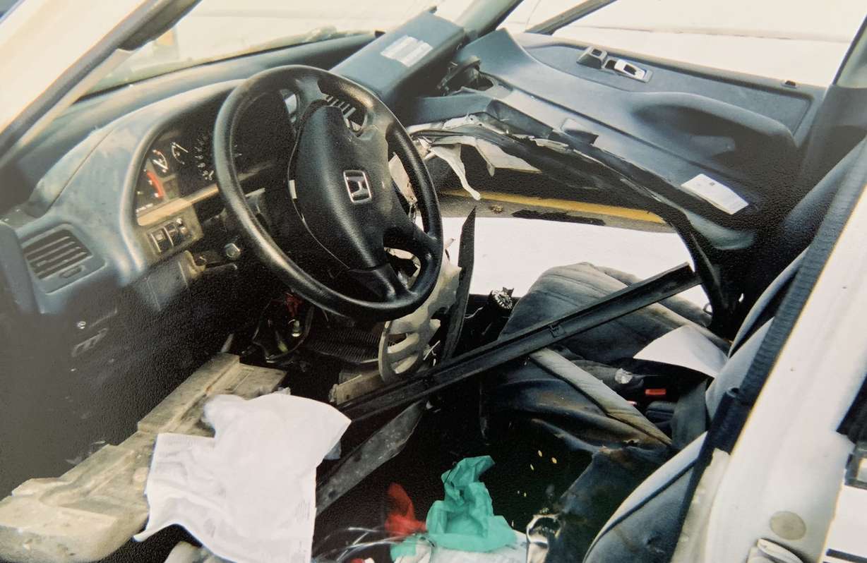 Jennifer Hughes, 45, was in a horrible accident in 2001, when she was 23.