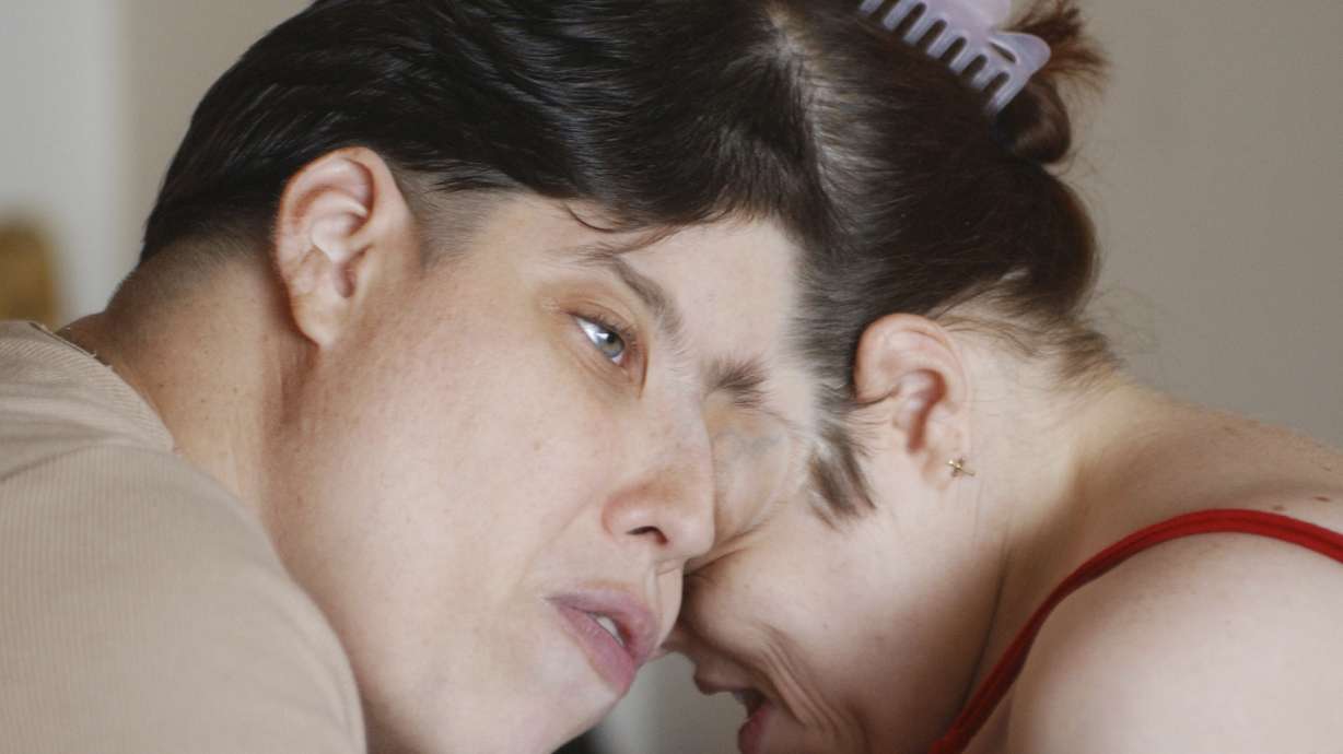 In this July 8, 2003 photo, Lori, left, and George Schappell, conjoined twins, are photographed in their Reading, Pa., apartment. Lori and George Schappell, who pursued separate careers, interests and relationships during lives that defied medical expectations, died April 7. They were 62.