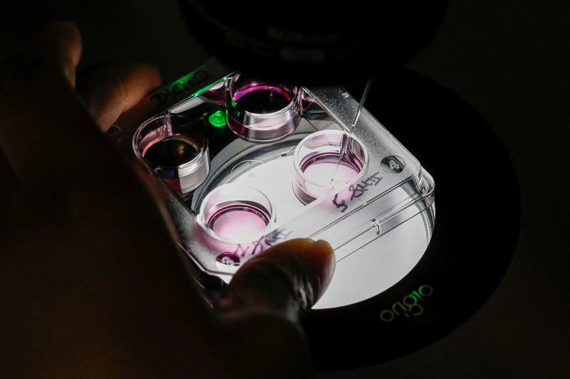 A medical technician selects eggs for an in-vitro fertilization procedure called Intracytoplasmic Sperm Injection at the Laboratory of Reproductive Biology CECOS of Tenon Hospital in Paris, France, September 19, 2019.