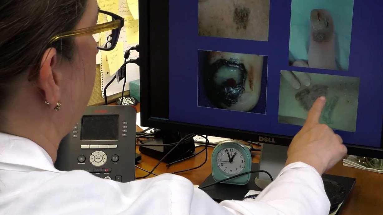 Dr. Nebhan shows examples of what skin blemishes to keep an eye on.