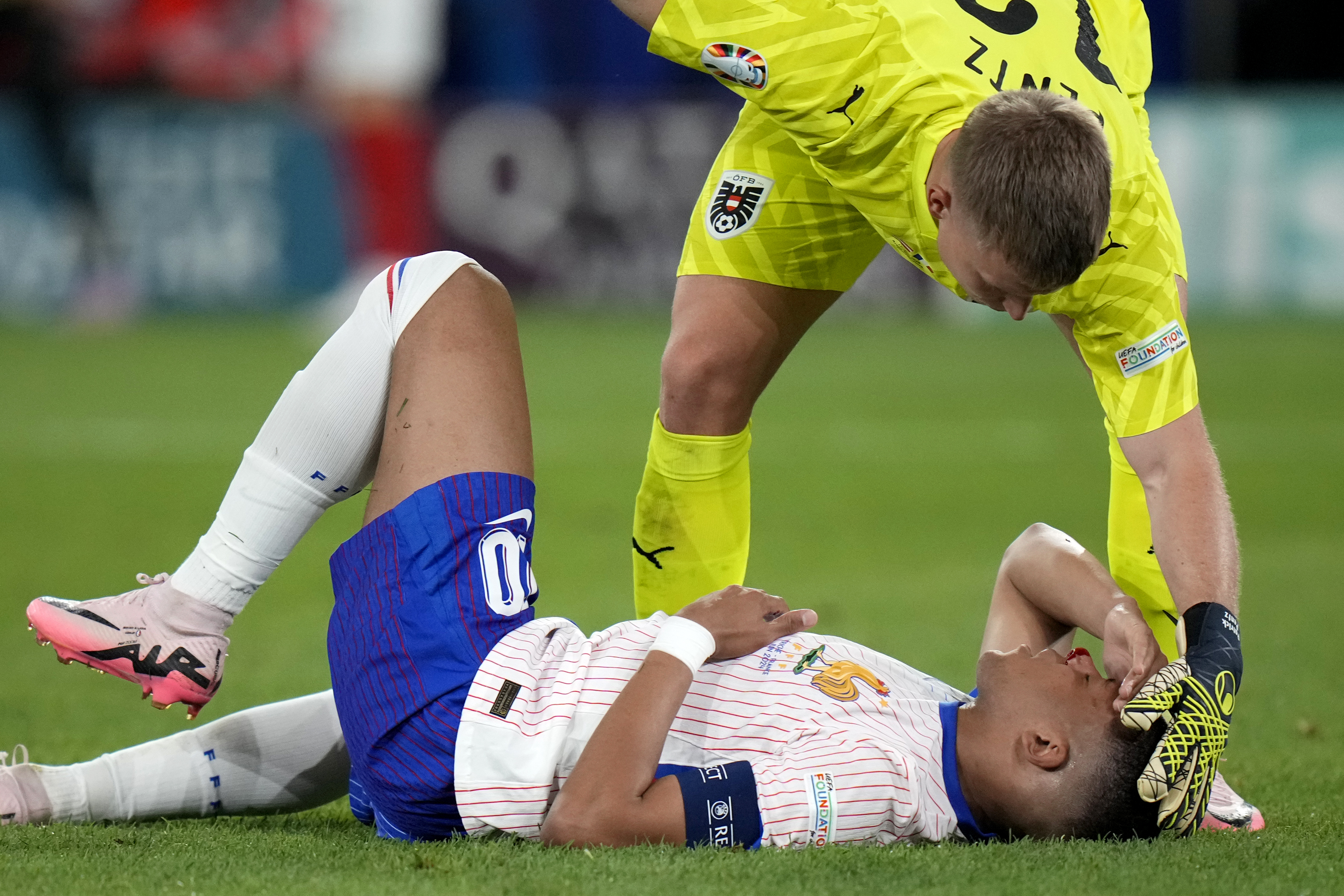 Kylian Mbappe of France receives a treatment after suffering an injury during a Group D match between Austria and France at the Euro 2024 soccer tournament in Duesseldorf, Germany, Monday, June 17, 2024.