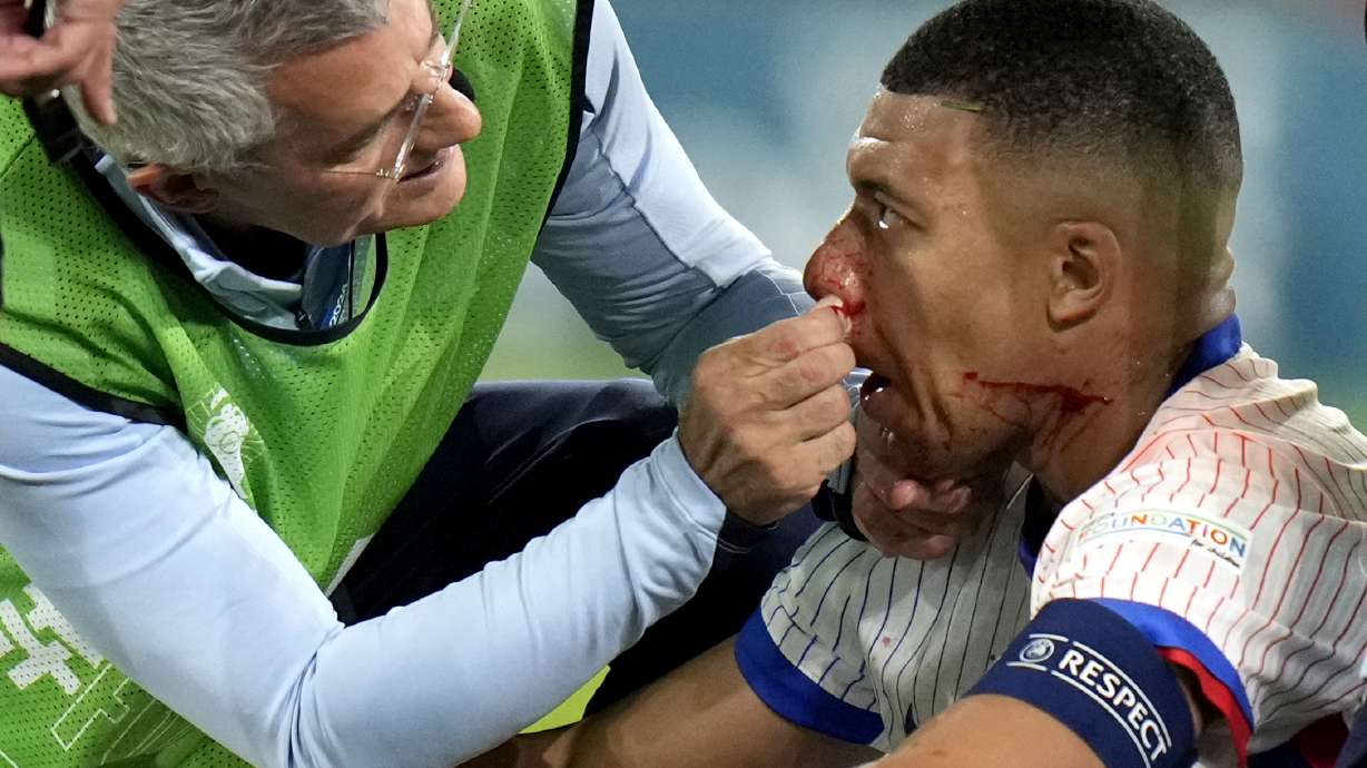 Kylian Mbappe of France receives a treatment after suffering an injury during a Group D match between Austria and France at the Euro 2024 soccer tournament in Duesseldorf, Germany, Monday, June 17, 2024.
