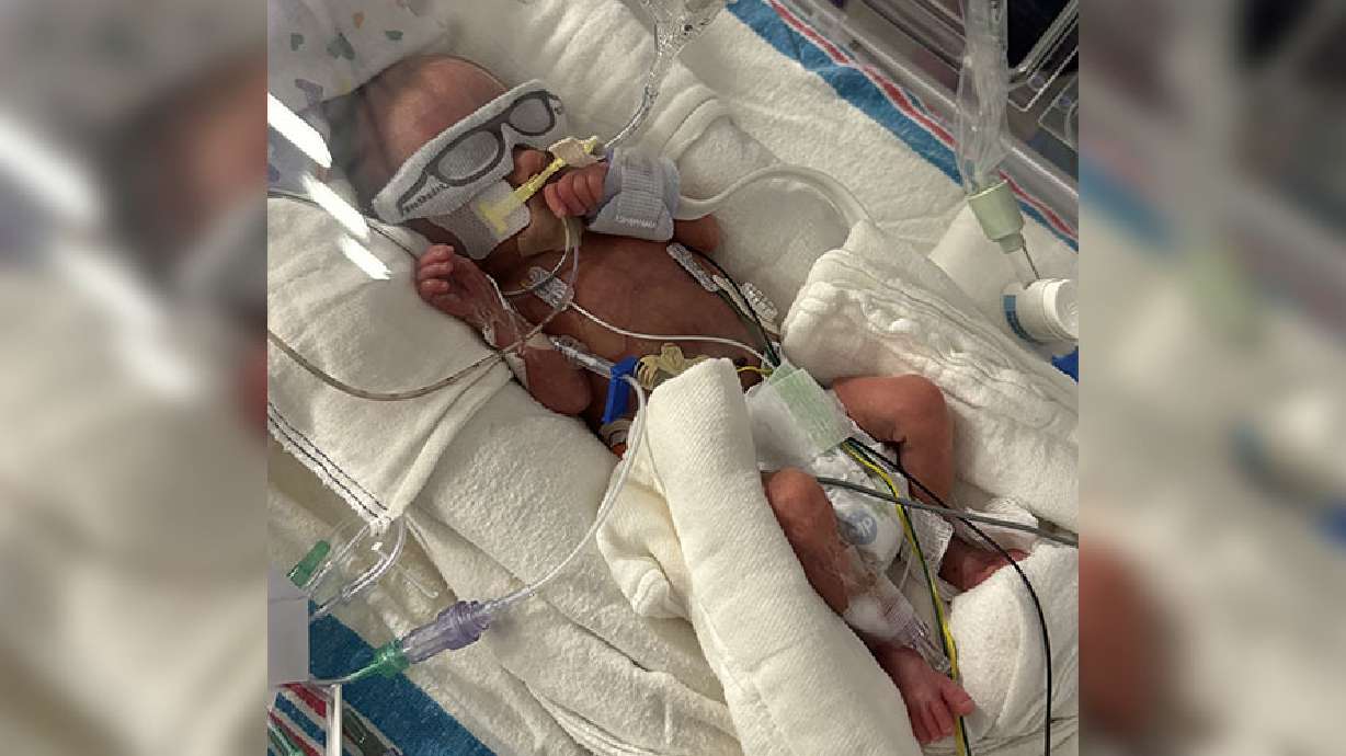 Micropreemie Dallas Klingler, of Idaho Falls, weighed 1 pound, 10 ounces when he was born at 26 weeks and three days.
