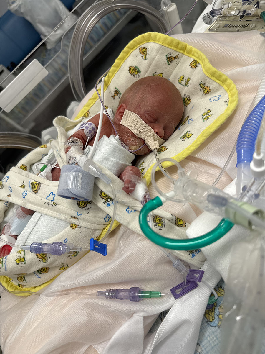 Micropreemie Born To Idaho Couple At 26 Weeks Is Fighting For His Life ...