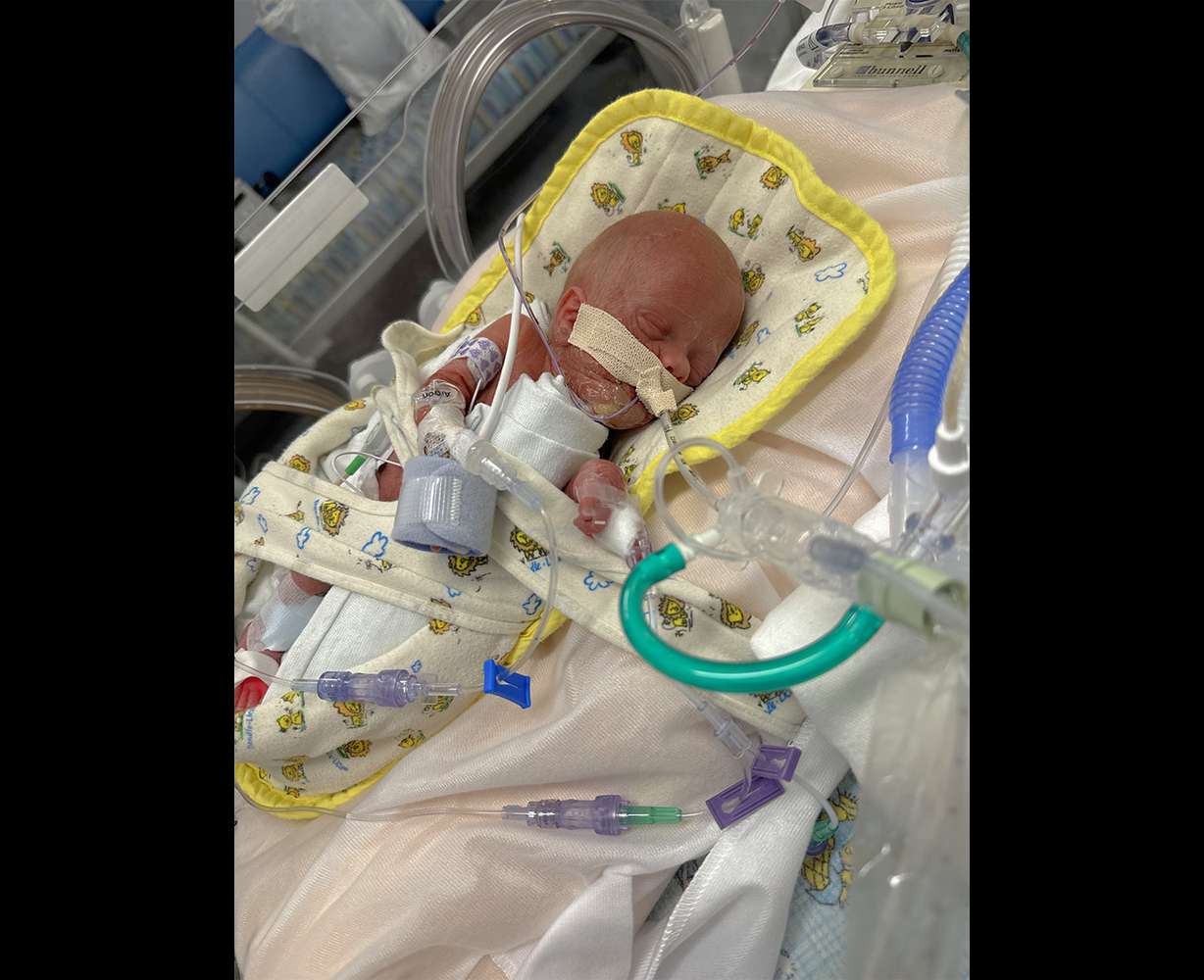 Micropreemie Dallas Klingler, of Idaho Falls, weighed 1 pound, 10 ounces when he was born at 26 weeks and three days.