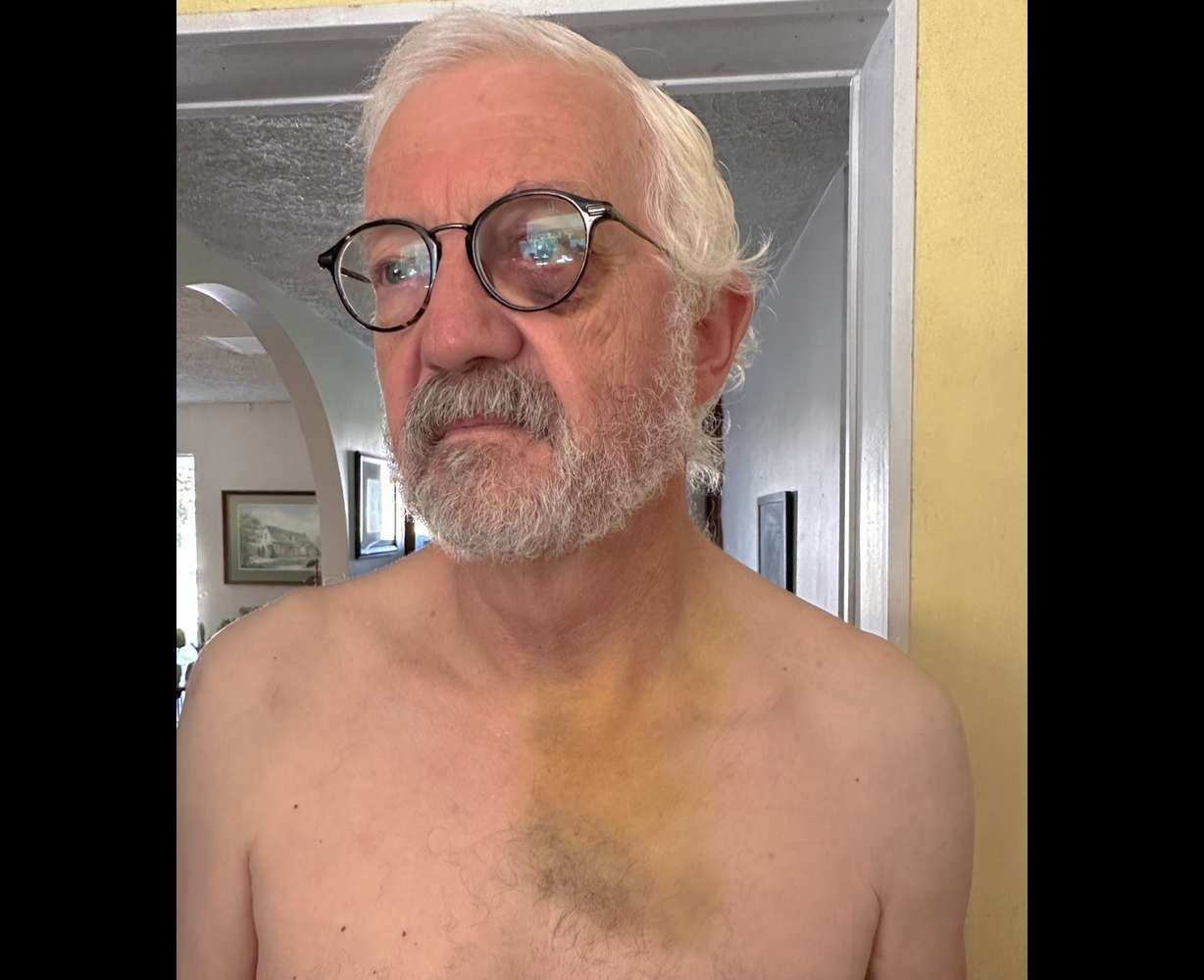 Steve Matheson, a helicopter mechanic, jumped to the rescue when he saw a problem while driving on I-215 last month. There was a collision and Matheson was injured.