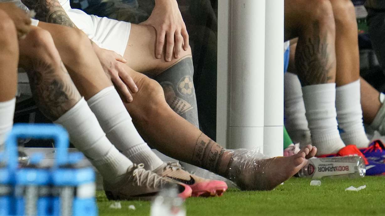 Argentina's Lionel Messi sits on the bench with an ice pack on his ankle during a Copa America soccer final match against Colombia in Miami Gardens, Fla., Sunday, July 14, 2024.