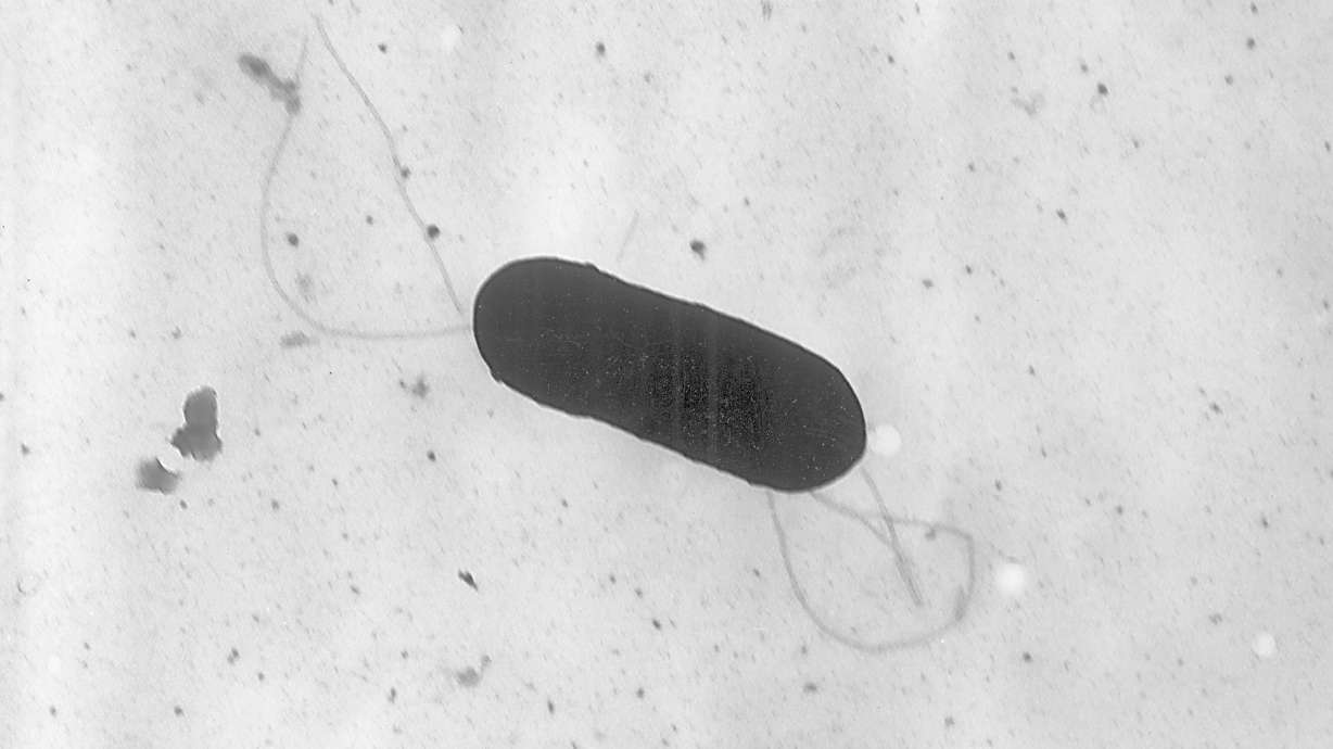This 2002 electron microscope image made available by the Centers for Disease Control and Prevention shows a listeria monocytogenes bacterium, responsible for the food-borne illness listeriosis.