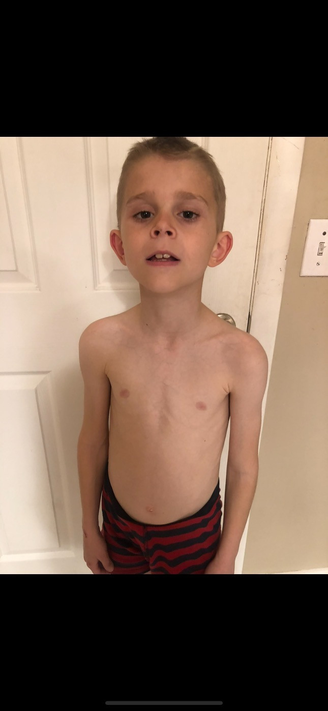 A photo of Gavin Peterson taken by his biological mother in February 2020, when she wanted to document what she considered to be signs of malnutrition.