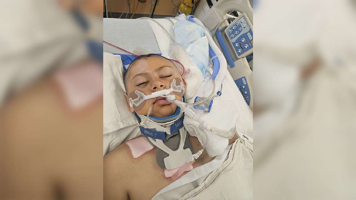 Dominic De La Cruz was injured Sept. 3 after being hit by a car while on his bicycle in Pocatello.