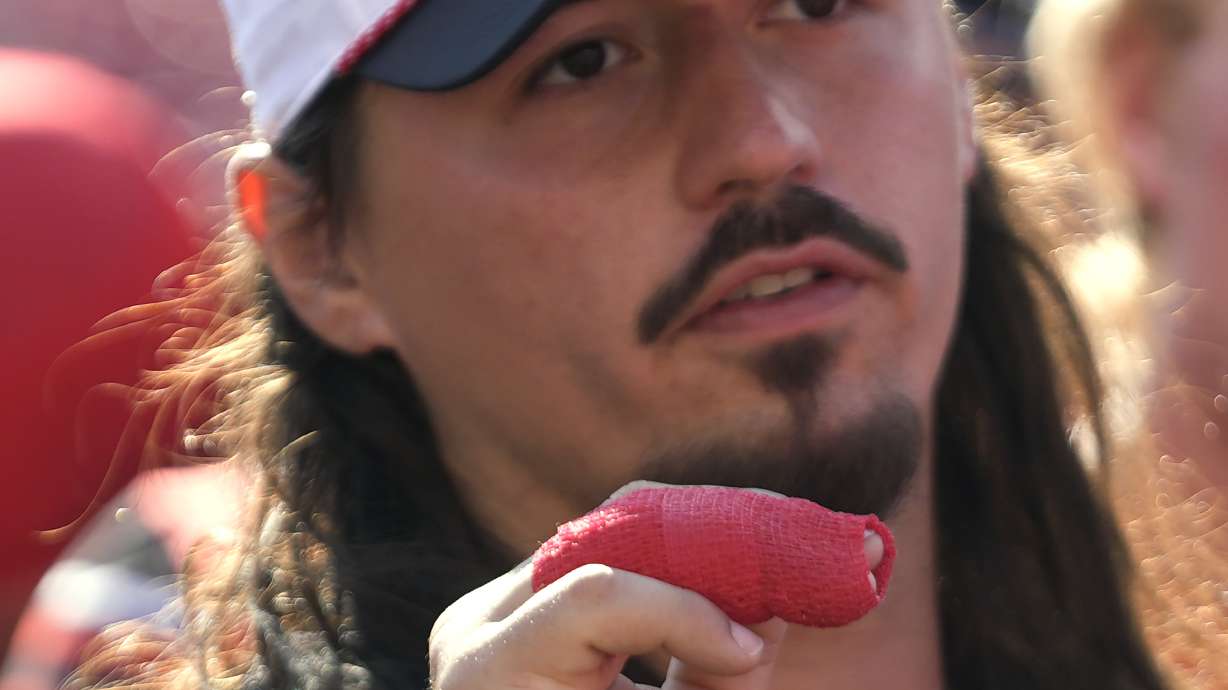 Utah quarterback Cameron Rising (7) has his fingers wrapped following their NCAA college football game against Baylor, Saturday, Sept. 7, 2024, in Salt Lake City.