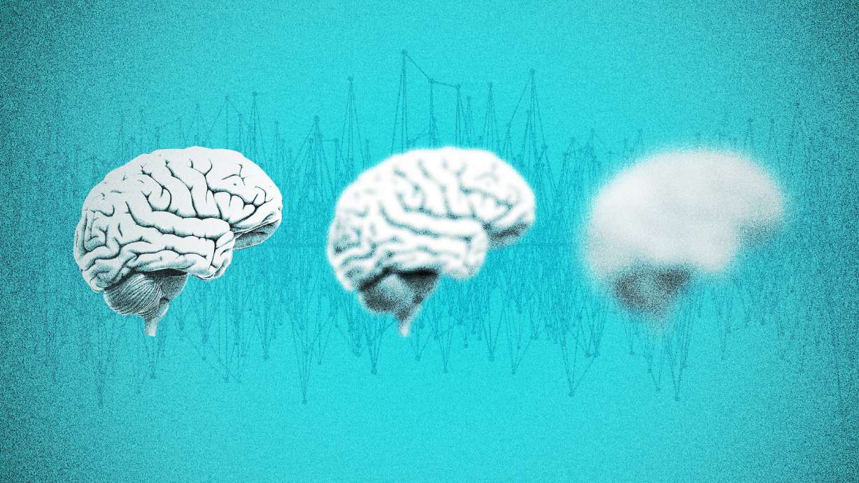When the world shut down in the pandemic, adolescent brains started aging faster — especially the brains of adolescent girls, researchers found.