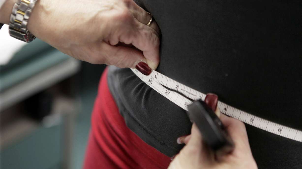 About 4 in 10 Americans have obesity overall and about 1 in 10 have severe obesity. That's according to new government research.
