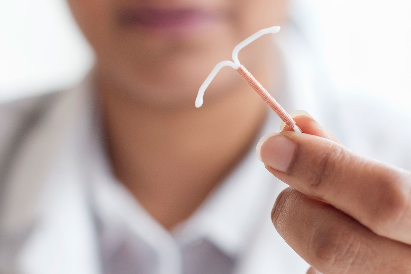 In the United States, about 1 in 10 women ages 15 to 49 uses an IUD or other form of long-acting reversible contraception, according to CDC data.