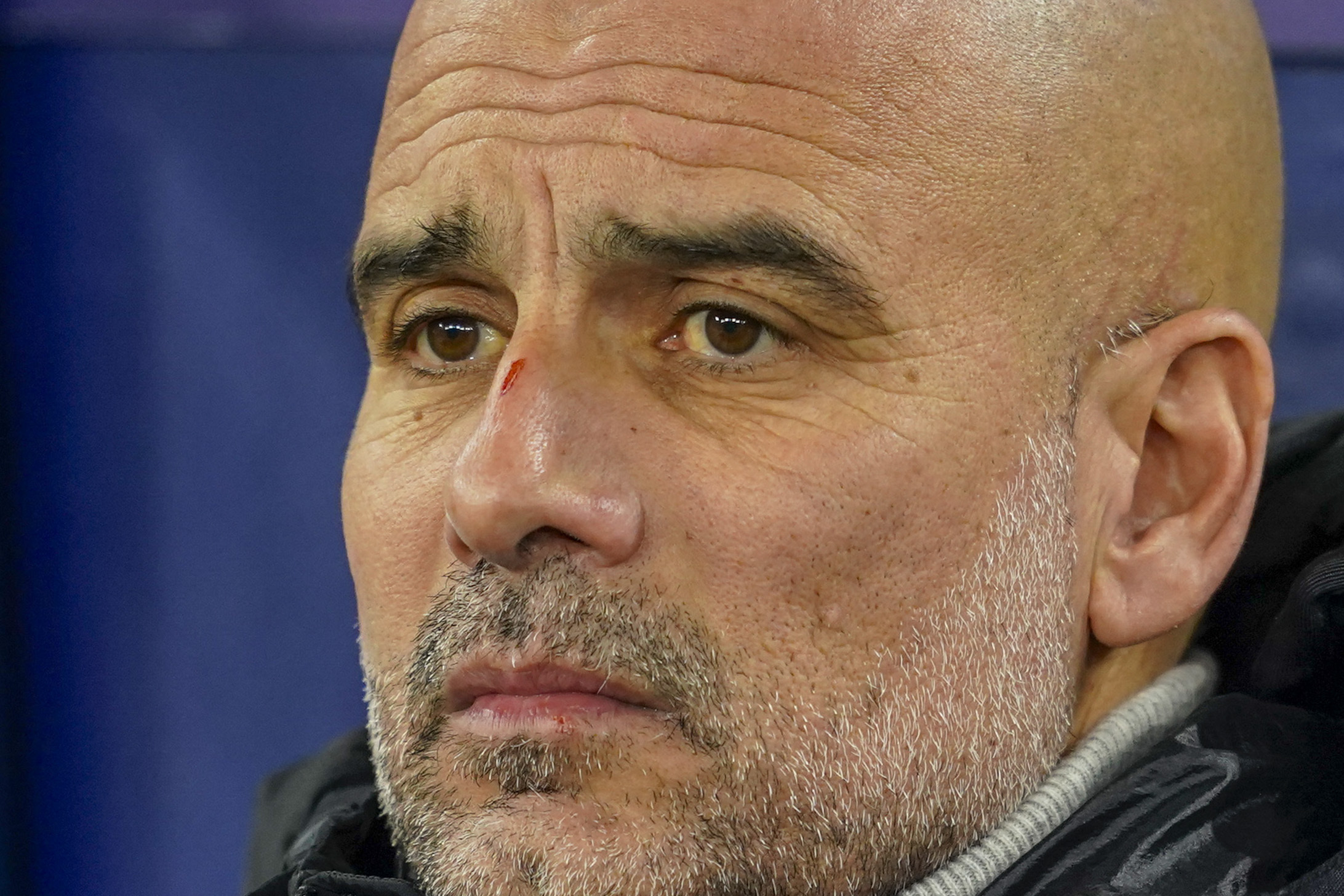 Pep Guardiola clarifies his remark about self harm made after Man City's latest bad result