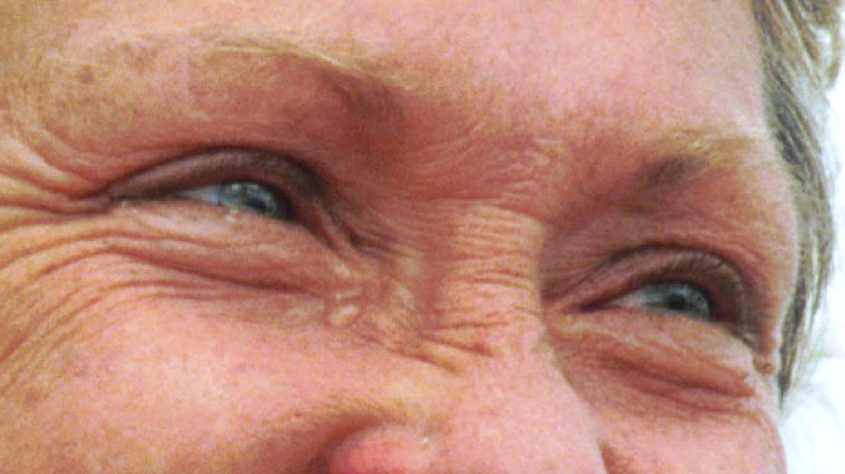 Contact Lenses and Tears