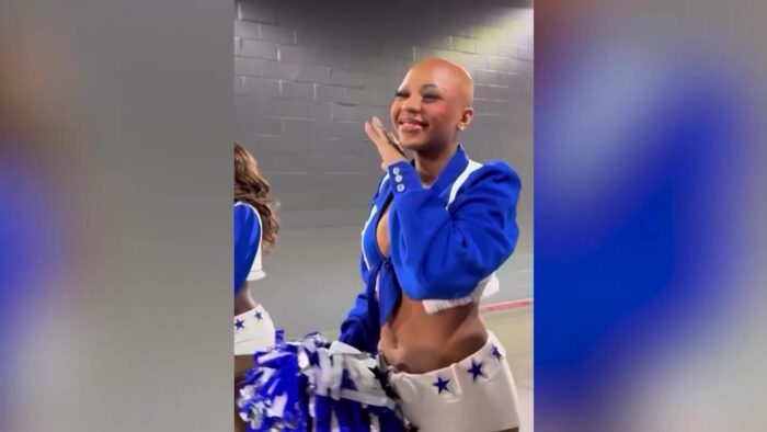 Dallas Cowboys cheerleader connects with Utah teen, spreading alopecia awareness