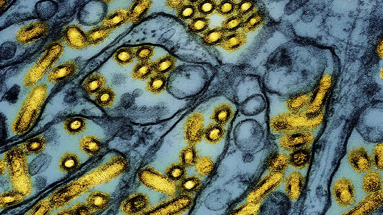 Health officials have confirmed the first case of severe illness in the U.S. caused by bird flu.