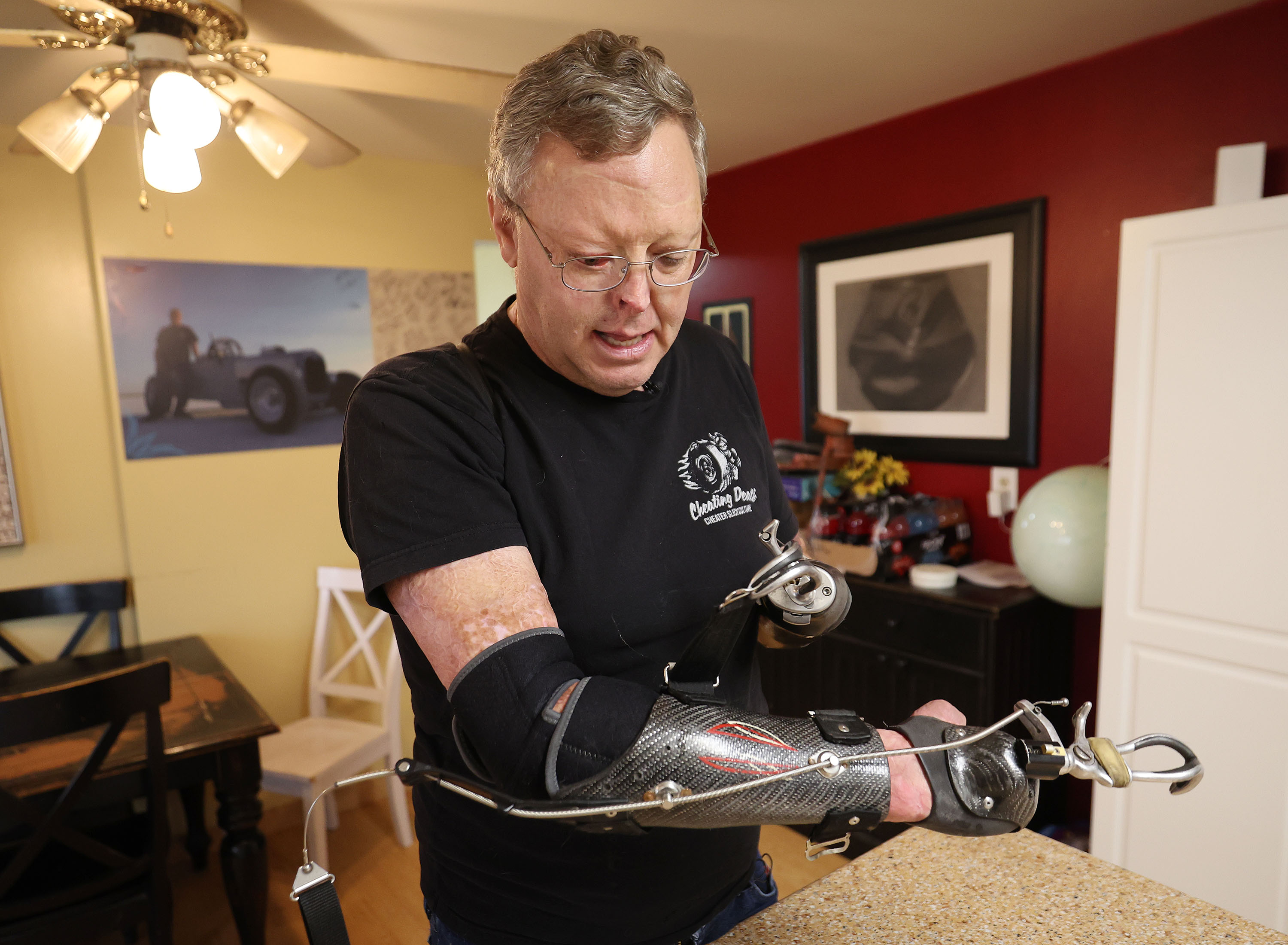 Mark Haley straps on prosthetics at his home in West Bountiful on Nov. 23. Haley was a race car driver and suffered burns and amputations after crashing while racing.