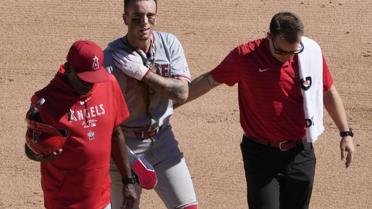 FILE - Los Angeles Angels' Zach Neto holds his shoulder as he heads to the dugout after being caught trying to steal second during the fourth inning of a baseball game against the Chicago White Sox on Thursday, Sept. 26, 2024, in Chicago.