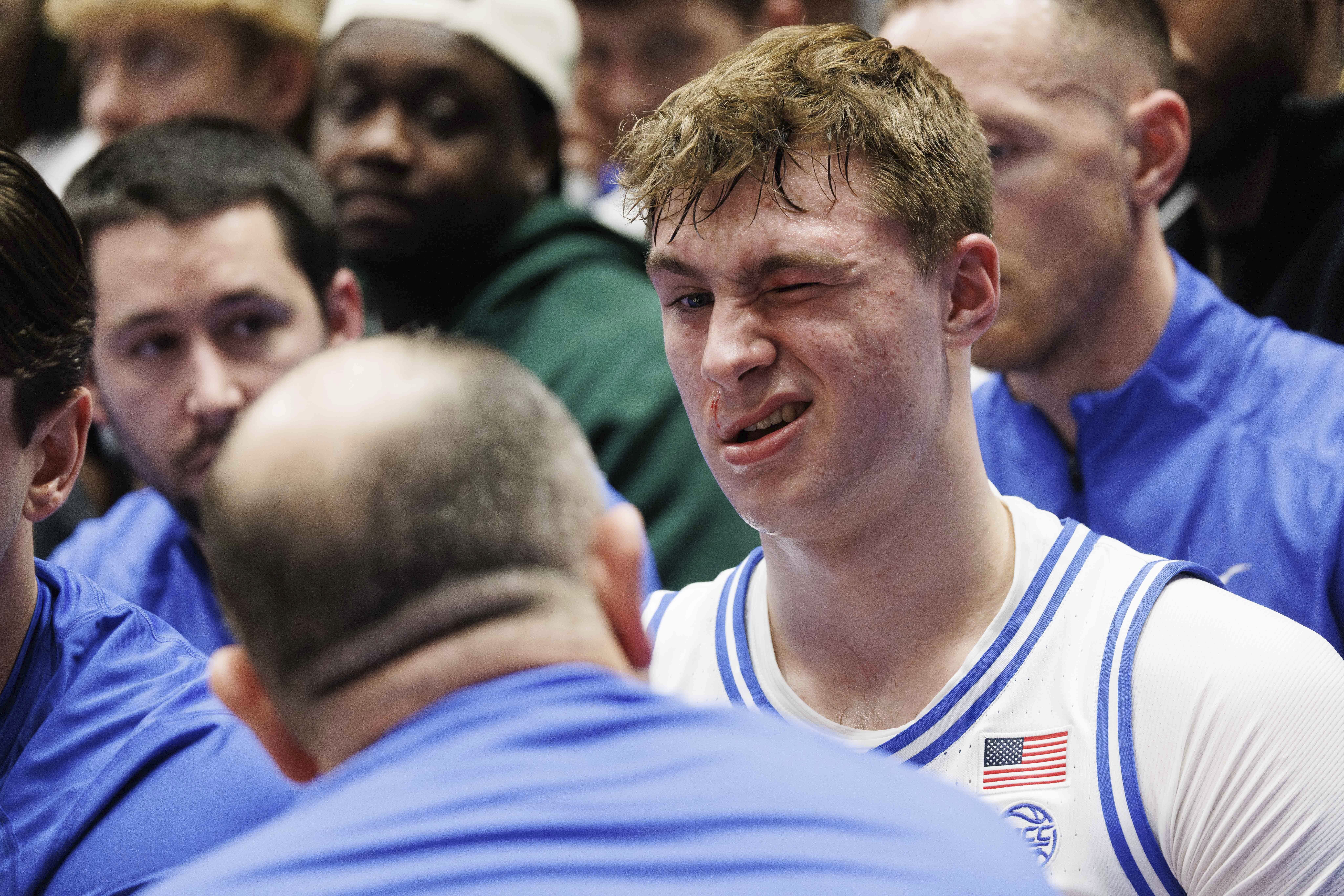 Duke's Cooper Flagg reacts on the bench after being accidentally hit in the face during the first half of an NCAA college basketball game against Florida State in Durham, N.C., Saturday, March 1, 2025.