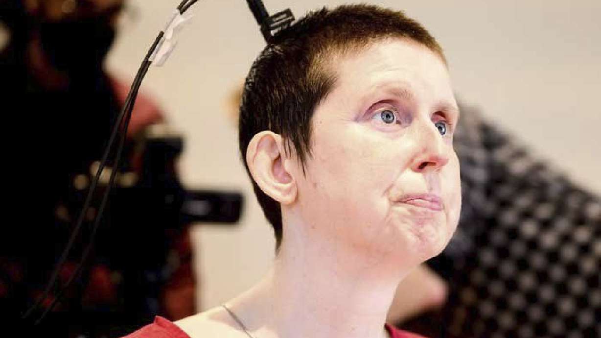 This photo provided by researchers at UC San Francisco and UC Berkeley shows Ann, a participant in a study on speech neuroprostheses, in California in 2023.