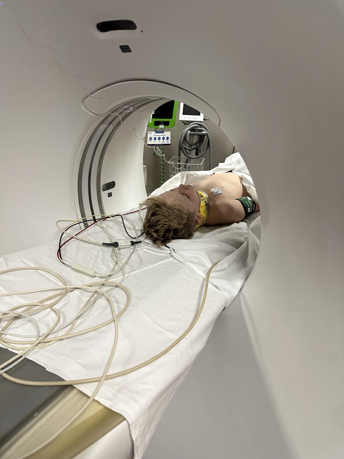 Eight-year-old Jake Smith is seen getting a CT scan after being blown 20 feet into the air.