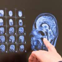 Utah couple shares journey navigating a terminal dementia diagnosis