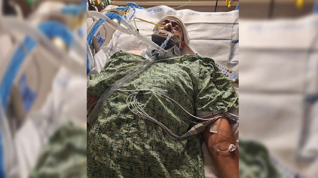 Casey Price is shown in the hospital after his one-ton truck fell on him in Osgood, Idaho, on April 24. He was released 19 days later.
